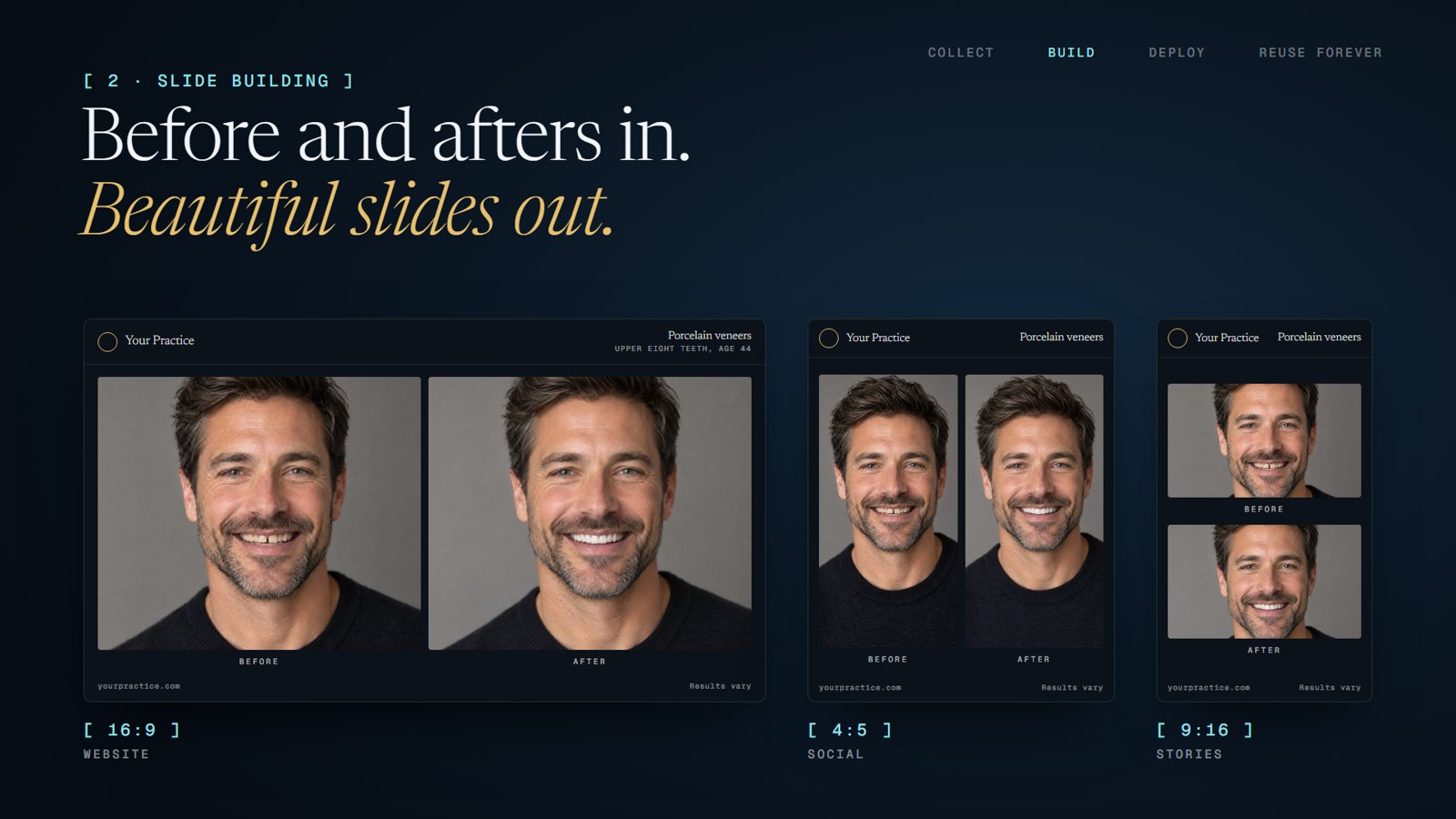 The same slide system for dentistry: a veneers case at 16:9, 4:5 and 9:16.