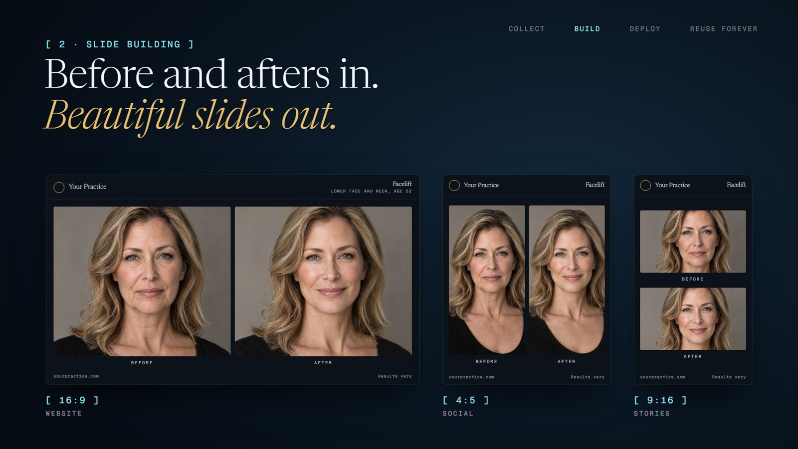 Before and afters in. Beautiful slides out. A facelift case at 16:9, 4:5 and 9:16.